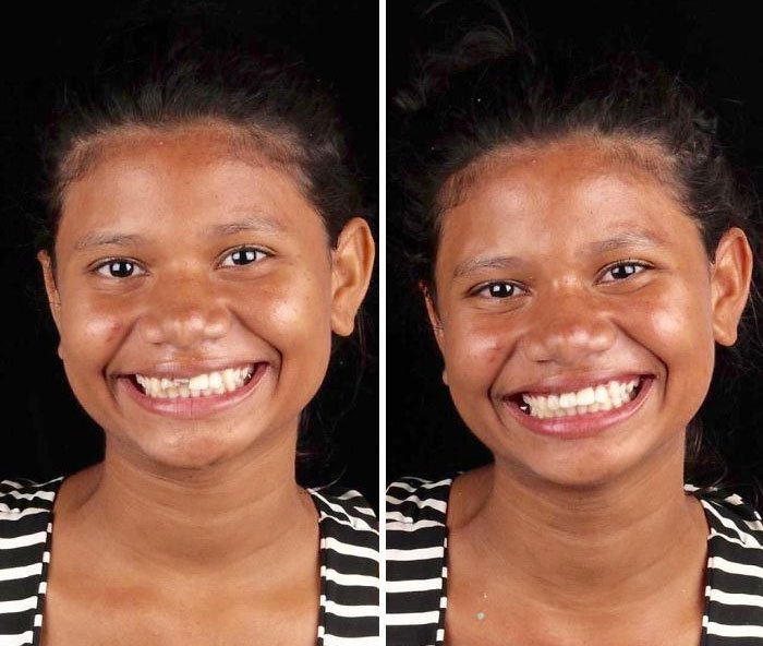 femme souriante après un traitement dentaire