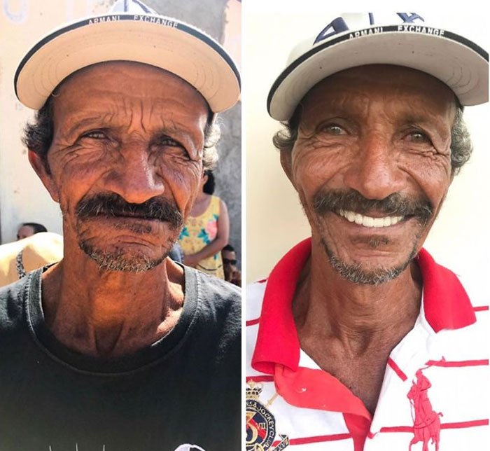 Homme souriant après un traitement dentaire